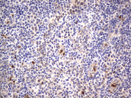 PRX-1 / PRRX1 Antibody - IHC of paraffin-embedded Human tonsil using anti-PRRX1 mouse monoclonal antibody. (Heat-induced epitope retrieval by 1 mM EDTA in 10mM Tris, pH8.5, 120°C for 3min).