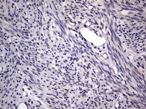 PRX-1 / PRRX1 Antibody - IHC of paraffin-embedded Human endometrium tissue using anti-PRRX1 mouse monoclonal antibody. (Heat-induced epitope retrieval by 1 mM EDTA in 10mM Tris, pH8.5, 120°C for 3min).