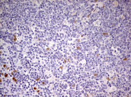 PRX-1 / PRRX1 Antibody - IHC of paraffin-embedded Human lymph node tissue using anti-PRRX1 mouse monoclonal antibody. (Heat-induced epitope retrieval by 10mM citric buffer, pH6.0, 120°C for 3min).