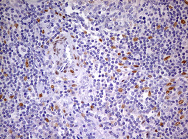 PRX-1 / PRRX1 Antibody - IHC of paraffin-embedded Human tonsil using anti-PRRX1 mouse monoclonal antibody. (Heat-induced epitope retrieval by 10mM citric buffer, pH6.0, 120°C for 3min).