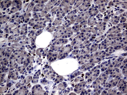 PRX-1 / PRRX1 Antibody - IHC of paraffin-embedded Human pancreas tissue using anti-PRRX1 mouse monoclonal antibody. (Heat-induced epitope retrieval by 10mM citric buffer, pH6.0, 120°C for 3min).