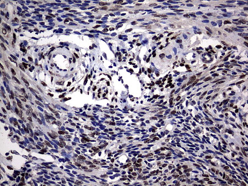 PRX-1 / PRRX1 Antibody - IHC of paraffin-embedded Human endometrium tissue using anti-PRRX1 mouse monoclonal antibody. (Heat-induced epitope retrieval by 10mM citric buffer, pH6.0, 120°C for 3min).
