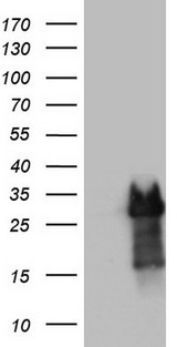 PRX-1 / PRRX1 Antibody - HEK293T cells were transfected with the pCMV6-ENTRY control (Left lane) or pCMV6-ENTRY PRRX1 (Right lane) cDNA for 48 hrs and lysed. Equivalent amounts of cell lysates (5 ug per lane) were separated by SDS-PAGE and immunoblotted with anti-PRRX1.