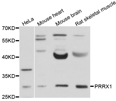 PRX-1 / PRRX1 Antibody - Western blot analysis of extracts of various cell lines, using PRRX1 antibody at 1:1000 dilution. The secondary antibody used was an HRP Goat Anti-Rabbit IgG (H+L) at 1:10000 dilution. Lysates were loaded 25ug per lane and 3% nonfat dry milk in TBST was used for blocking. An ECL Kit was used for detection and the exposure time was 1s.