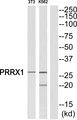 PRX-1 / PRRX1 Antibody - Western blot analysis of extracts from NIH-3T3/K562 cells, using PRRX1 antibody.