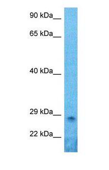 PRX-1 / PRRX1 Antibody - Western blot of PRRX1 Antibody with human HeLa Whole Cell lysate.  This image was taken for the unconjugated form of this product. Other forms have not been tested.