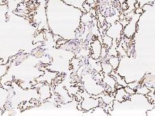 PRX / Periaxin Antibody - Immunochemical staining of human PRX in human lung with rabbit polyclonal antibody at 1:100 dilution, formalin-fixed paraffin embedded sections.