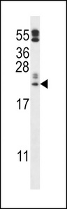 PRXL2A / FAM213A Antibody - C10orf58 Antibody western blot of A2058 cell line lysates (35 ug/lane). The C10orf58 antibody detected the C10orf58 protein (arrow).