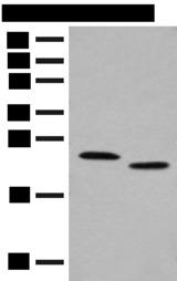 PRXL2A / FAM213A Antibody - Western blot analysis of Human fat tissue and A375 cell lysates  using FAM213A Polyclonal Antibody at dilution of 1:400