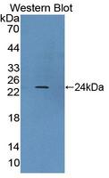 PS20 / WFDC1 Antibody - Western blot of PS20 / WFDC1 antibody.