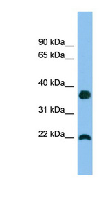 PS20 / WFDC1 Antibody - WFDC1 antibody Western blot of A549 cell lysate. This image was taken for the unconjugated form of this product. Other forms have not been tested.