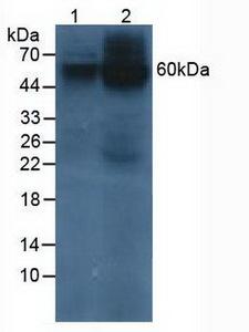 PSAP / Prosaposin Antibody - Western Blot; Sample: Lane1: Human 293T Cells; Lane2: Human HeLa Cells.