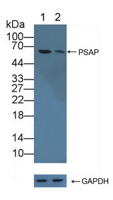 PSAP / Prosaposin Antibody - Knockout Varification: Lane 1: Wild-type 293T cell lysate; Lane 2: PSAP knockout 293T cell lysate; Predicted MW: 58kd Observed MW: 60kd Primary Ab: 2µg/ml Rabbit Anti-Human PSAP Antibody Second Ab: 0.2µg/mL HRP-Linked Caprine Anti-Rabbit IgG Polyclonal Antibody
