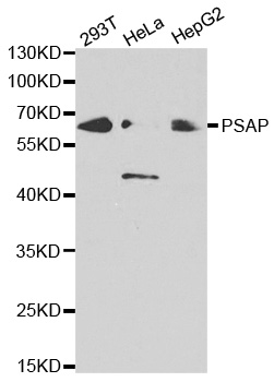 PSAP / Prosaposin Antibody - Western blot analysis of extracts of various cell lines.