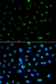 PSAP / Prosaposin Antibody - Immunofluorescence analysis of MCF7 cells.