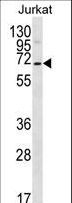 PSAPL1 Antibody - PSAPL1 Antibody western blot of Jurkat cell line lysates (35 ug/lane). The PSAPL1 antibody detected the PSAPL1 protein (arrow).