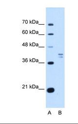 PSAT1 Antibody - Lane A: Marker. Lane B: HepG2 cell lysate. Antibody concentration: 1.0 ug/ml. Gel concentration: 12%.  This image was taken for the unconjugated form of this product. Other forms have not been tested.