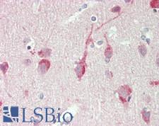 PSAT1 Antibody - Human Brain, Cortex: Formalin-Fixed, Paraffin-Embedded (FFPE).  This image was taken for the unconjugated form of this product. Other forms have not been tested.