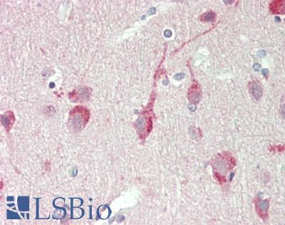 PSAT1 Antibody - Human Brain, Cortex: Formalin-Fixed, Paraffin-Embedded (FFPE).  This image was taken for the unconjugated form of this product. Other forms have not been tested.