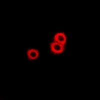 PSAT1 Antibody - Immunofluorescent analysis of PSAT1 staining in U2OS cells. Formalin-fixed cells were permeabilized with 0.1% Triton X-100 in TBS for 5-10 minutes and blocked with 3% BSA-PBS for 30 minutes at room temperature. Cells were probed with the primary antibody in 3% BSA-PBS and incubated overnight at 4 deg C in a humidified chamber. Cells were washed with PBST and incubated with a DyLight 594-conjugated secondary antibody (red) in PBS at room temperature in the dark.