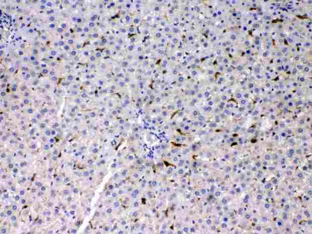 PSAT1 Antibody - PSAT1 was detected in paraffin-embedded sections of rat liver tissues using rabbit anti- PSAT1 Antigen Affinity purified polyclonal antibody
