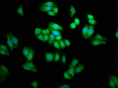 PSAT1 Antibody - Immunofluorescence staining of HepG2 cells at a dilution of 1:66, counter-stained with DAPI. The cells were fixed in 4% formaldehyde, permeabilized using 0.2% Triton X-100 and blocked in 10% normal Goat Serum. The cells were then incubated with the antibody overnight at 4 °C.The secondary antibody was Alexa Fluor 488-congugated AffiniPure Goat Anti-Rabbit IgG (H+L) .