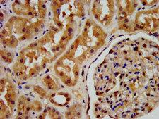 PSAT1 Antibody - Immunohistochemistry image at a dilution of 1:200 and staining in paraffin-embedded human kidney tissue performed on a Leica BondTM system.