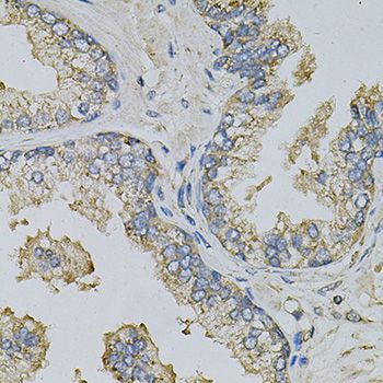 PSAT1 Antibody - Immunohistochemistry of paraffin-embedded human prostate using PSAT1 Antibody at dilution of 1:100 (40x lens).