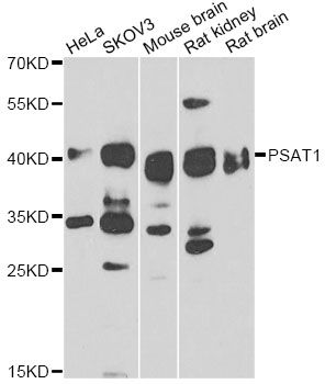 PSAT1 Antibody - Western blot analysis of extracts of various cell lines, using PSAT1 antibody at 1:1000 dilution. The secondary antibody used was an HRP Goat Anti-Rabbit IgG (H+L) at 1:10000 dilution. Lysates were loaded 25ug per lane and 3% nonfat dry milk in TBST was used for blocking. An ECL Kit was used for detection and the exposure time was 90s.