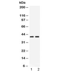 PSAT1 Antibody - Western blot testing of 1) rat pancreas and 2) human HeLa lysate with PSAT1 antibody at 0.5ug/ml. Predicted/observed molecular weight ~40 kDa.