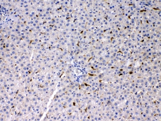 PSAT1 Antibody - IHC testing of FFPE rat liver with PSAT1 antibody at 1ug/ml. HIER: steam section in pH6 citrate buffer for 20 min.