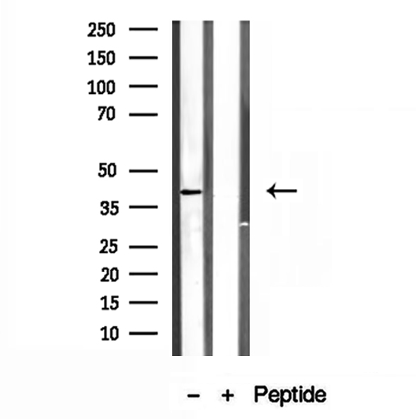 PSAT1 Antibody - Western blot analysis of extracts of HepG2 cells using PSAT1 antibody.
