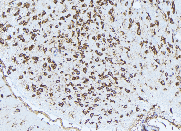 PSAT1 Antibody - 1:100 staining rat brain tissue by IHC-P. The sample was formaldehyde fixed and a heat mediated antigen retrieval step in citrate buffer was performed. The sample was then blocked and incubated with the antibody for 1.5 hours at 22°C. An HRP conjugated goat anti-rabbit antibody was used as the secondary.