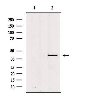 PSAT1 Antibody - Western blot analysis of extracts of rat brain tissue using PSAT1 antibody. Lane 1 was treated with the blocking peptide.