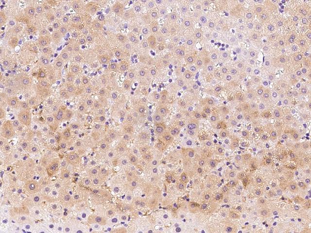 PSAT1 Antibody - Immunochemical staining of human PSAT1 in human liver with rabbit polyclonal antibody at 1:1000 dilution, formalin-fixed paraffin embedded sections.