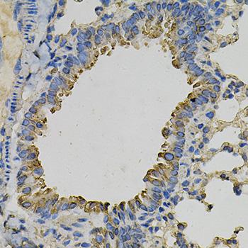 PSAT1 Antibody - Immunohistochemistry of paraffin-embedded Mouse lung using PSAT1 Polyclonal Antibody at dilution of 1:100 (40x lens).