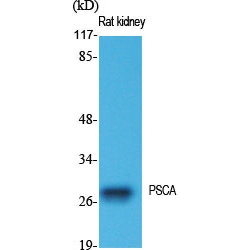 PSCA Antibody - Western blot of PSCA antibody