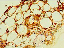 PSCA Antibody - Immunohistochemistry of paraffin-embedded human trachea using antibody at 1:100 dilution.