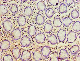 PSCA Antibody - Immunohistochemistry of paraffin-embedded human rectum using antibody at 1:100 dilution.