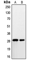 PSCA Antibody - Western blot analysis of PSCA expression in DU145 (A); human prostate (B) whole cell lysates.