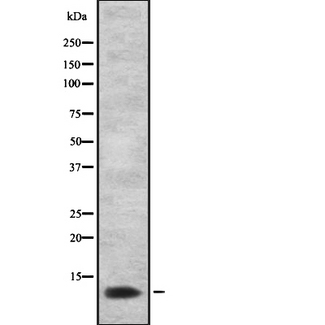 PSCA Antibody - Western blot analysis of Prostate Stem cells Antigen using LOVO cells whole cells lysates
