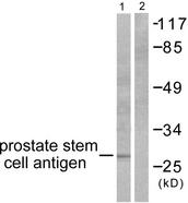 PSCA Antibody - Western blot analysis of extracts from mouse prostate, using Prostate Stem Cell Antigen antibody.
