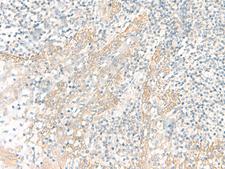 PSCA Antibody - Immunohistochemistry of paraffin-embedded Human tonsil tissue  using PSCA Polyclonal Antibody at dilution of 1:25(×200)