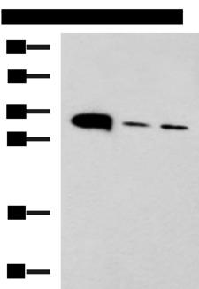 PSCA Antibody - Western blot analysis of Mouse heart tissue Mouse stomach tissue and PC-3 cell lysates  using PSCA Polyclonal Antibody at dilution of 1:650