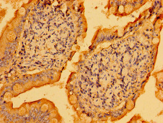 PSD Antibody - Immunohistochemistry image of paraffin-embedded human small intestine tissue at a dilution of 1:100