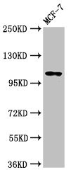 PSD Antibody - Positive Western Blot detected in MCF-7 whole cell lysate. All lanes: PSD antibody at 3.2 µg/ml Secondary Goat polyclonal to rabbit IgG at 1/50000 dilution. Predicted band size: 110, 71 KDa. Observed band size: 110 KDa