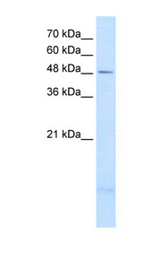 PSD3 Antibody - PSD3 antibody ARP42443_T100-NP_996792-PSD3(pleckstrin and Sec7 domain containing 3) Antibody Western blot of A204 cell lysate.  This image was taken for the unconjugated form of this product. Other forms have not been tested.