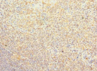 PSD4 Antibody - Immunohistochemistry of paraffin-embedded human tonsil tissue using PSD4 Antibody at dilution of 1:100