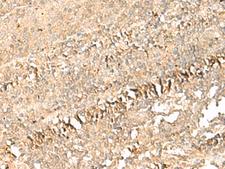 PSD4 Antibody - Immunohistochemistry of paraffin-embedded Human tonsil tissue  using PSD4 Polyclonal Antibody at dilution of 1:50(×200)