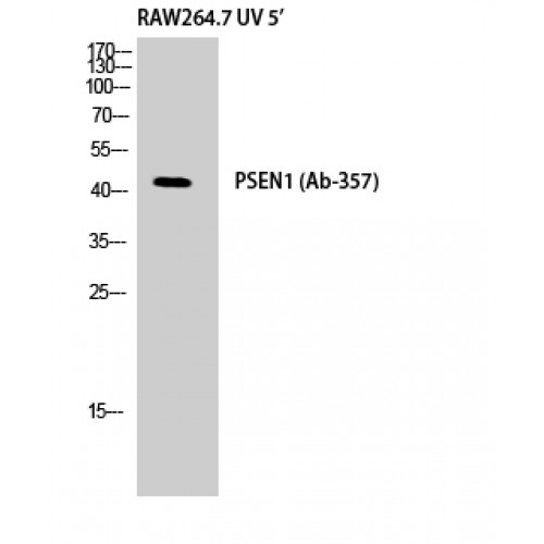 PSEN1 / Presenilin 1 Antibody - Western blot of Presenilin 1 antibody
